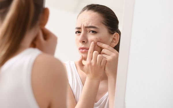 Mặt tự nhiên nổi nhiều mụn trứng cá, phải làm sao?