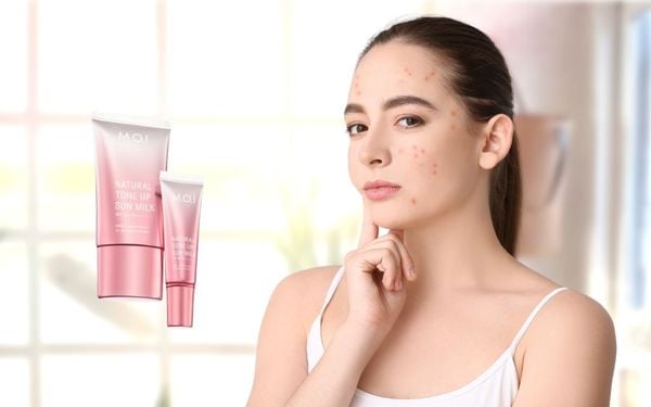 Mới nặn mụn xong có nên bôi kem chống nắng không?