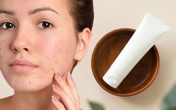 Sữa rửa mặt dành cho tuổi dậy thì: Những điều bạn cần biết