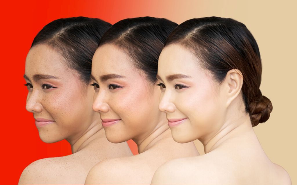 Tái tạo da là gì? Tất tần tật về tái tạo da mà bạn không nên bỏ qua