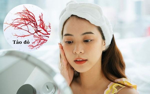 Tảo đỏ: Bí quyết chăm sóc sắc đẹp từ đại dương