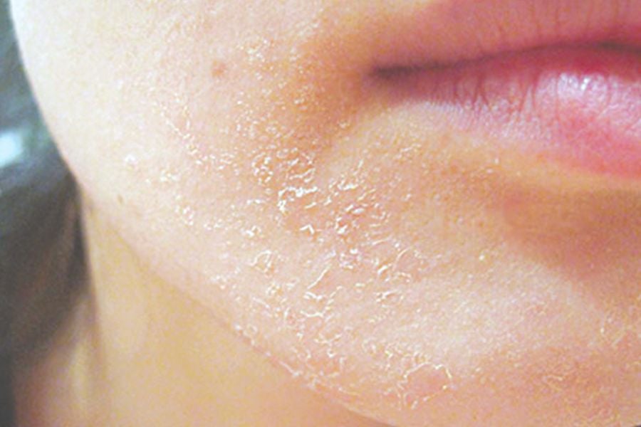 Tại sao khi makeup da mặt bị khô