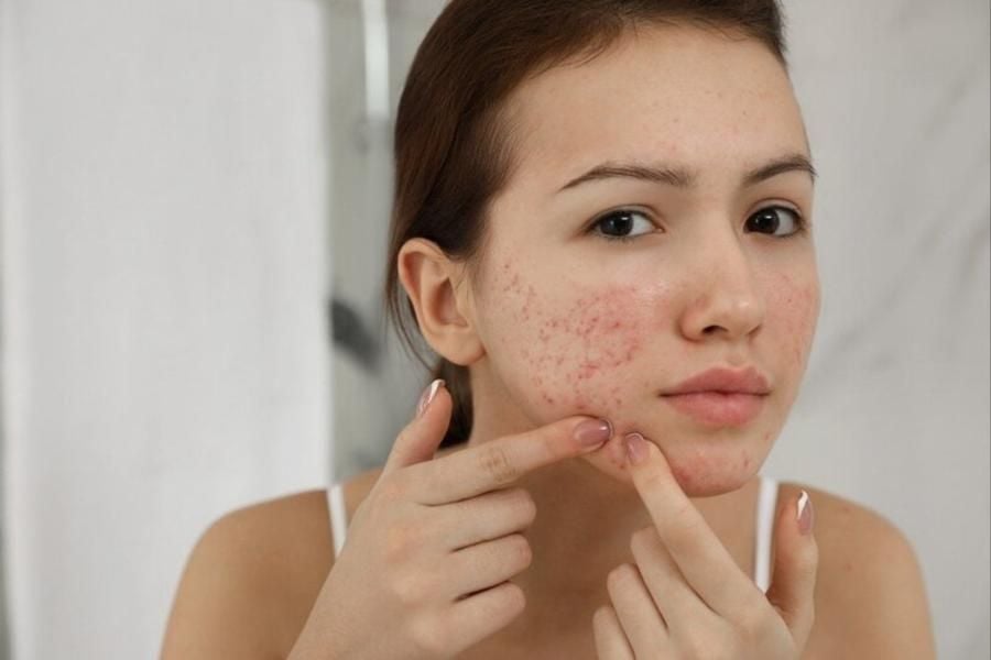 Dùng phấn phủ có hại da không?