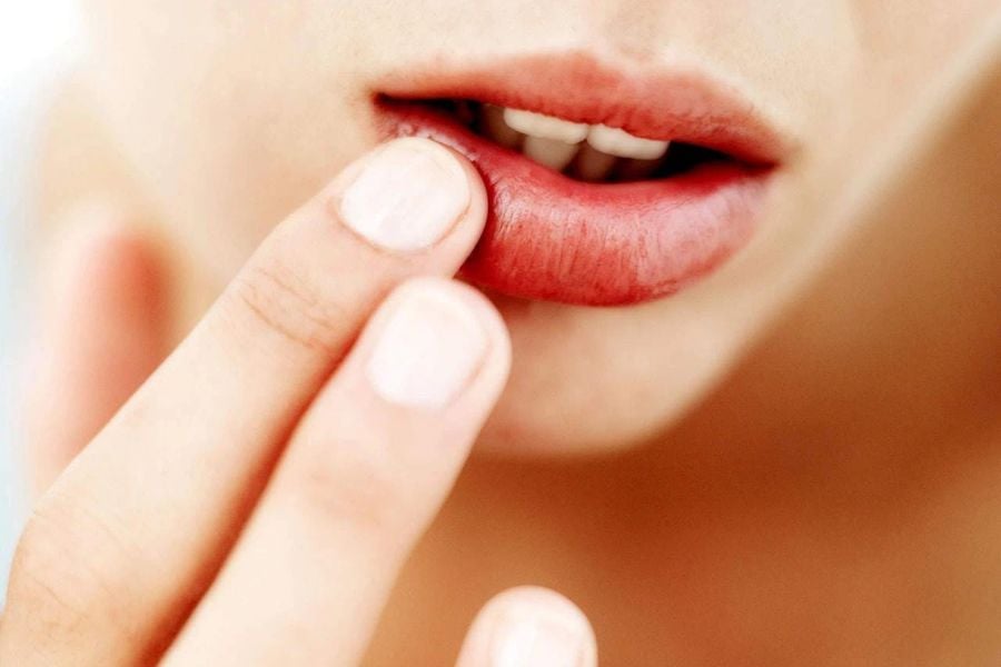 Những triệu chứng khi bị dị ứng son môi