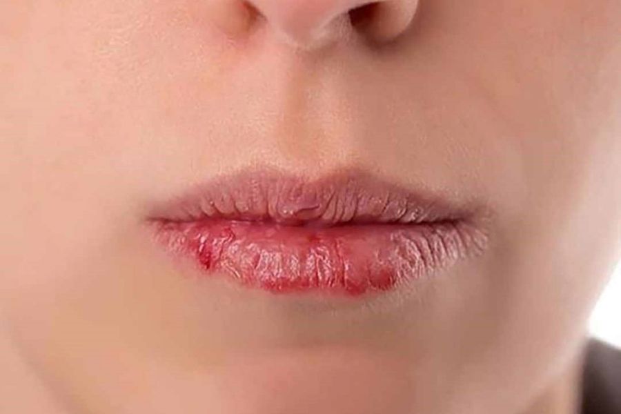 Các lưu ý khi sử dụng son môi đối với những người dễ bị dị ứng
