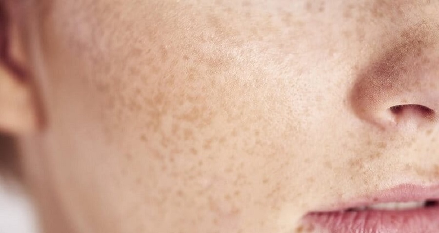 Làn da của phụ nữ thay đổi như thế nào sau khi sinh con