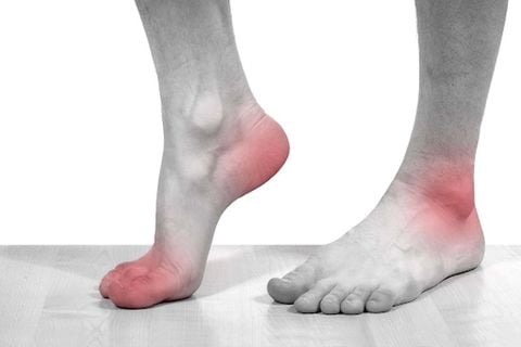 10 điều cần biết về các biến chứng của bệnh gout
