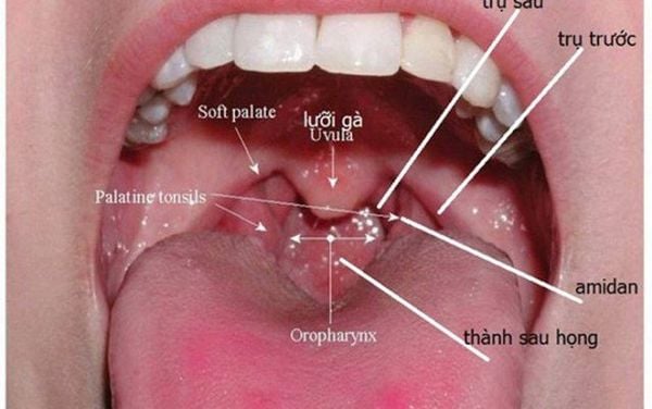 Dấu hiệu ung thư vòm họng