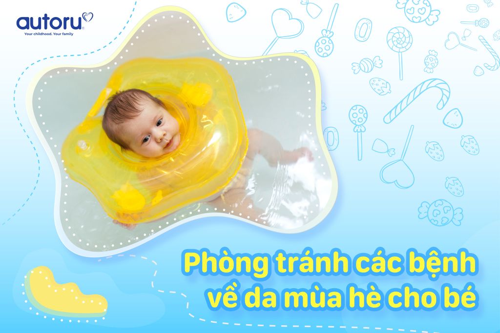 Phòng tránh các bệnh về da mùa hè cho trẻ sơ sinh