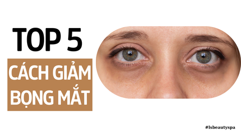 Bật Mí Top 5 Cách Làm Giảm Bọng Mắt Được Yêu Thích Nhất