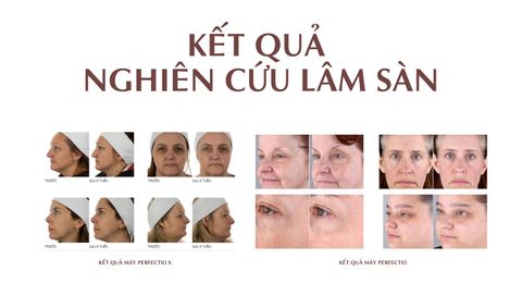 Các Thiết Bị Làm Đẹp Thương Hiệu Zero Gravity Mà Chị Em Không Nên Bỏ Qua