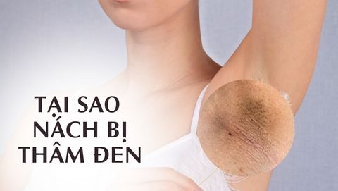Tại Sao Nách Bị Thâm Đen?