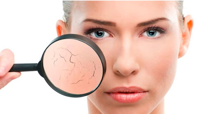 MẸO CHĂM SÓC CHO DA KHÔ