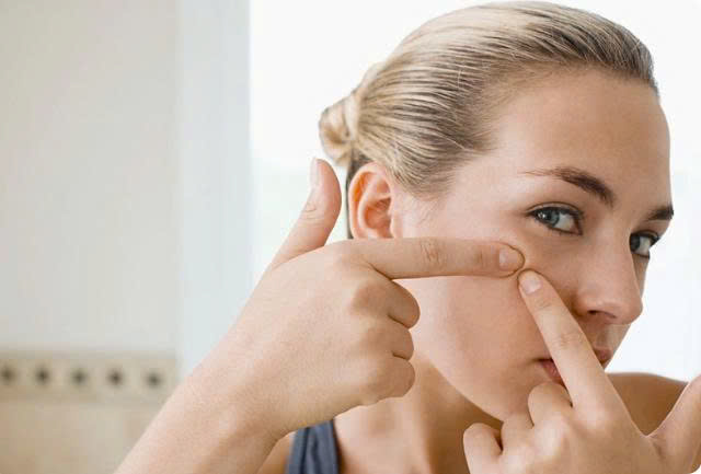 CÁCH ĐỐI PHÓ VỚI ĐỢT BÙNG PHÁT MỤN LIÊN QUAN ĐẾN KỲ KINH