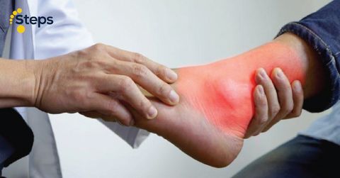 Những điều cần biết về đau khớp cổ chân