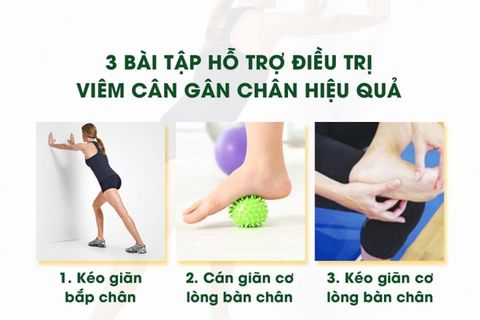 Bài Tập Nâng Cao Hỗ Trợ Trị Bệnh Viêm Cân Gan Chân