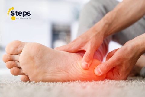 ĐAU GÓT CHÂN VÀ CÁCH ĐIỀU TRỊ TẠI NHÀ TRONG MÙA COVID