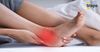 Những điều cần biết về đau mắt cá chân