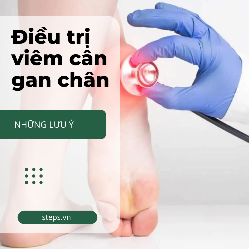 Những lưu ý khi điều trị viêm cân gan chân