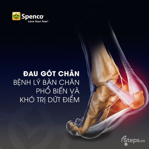 Đau Gót Chân: Nguyên Nhân, Triệu Chứng và Cách Điều Trị