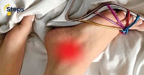 Vì sao bạn bị đau mắt cá chân? Có những cách nào điều trị đau mắt cá chân?