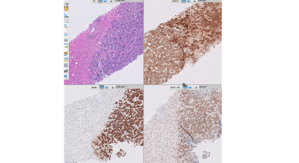 Nghiên cứu và ứng dụng Giải phẫu bệnh kỹ thuật số