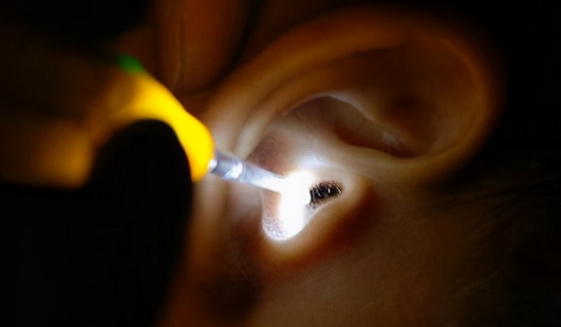 Bé trai đang ngủ thì kêu đau tai, mẹ tức tốc đưa con vào viện, bác sĩ gắp ra 1 con vật trong tai trước sự ngỡ ngàng của mẹ