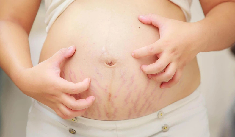 Mẹ bầu 31 tuần bị ngứa da và xém sảy thai, không nên chịu đựng và chủ quan với hiện tượng thường gặp trong thai kì