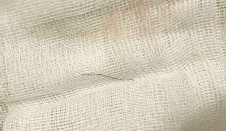 Cảnh báo dị vật tiêu hóa ở trẻ em