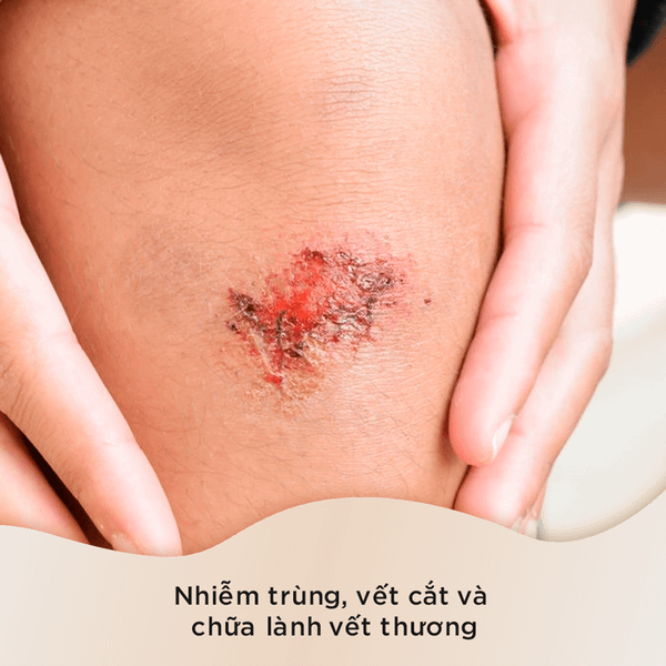 Tinh dầu tràm trà giúp chữa lành vết thương do vi khuẩn gây ra