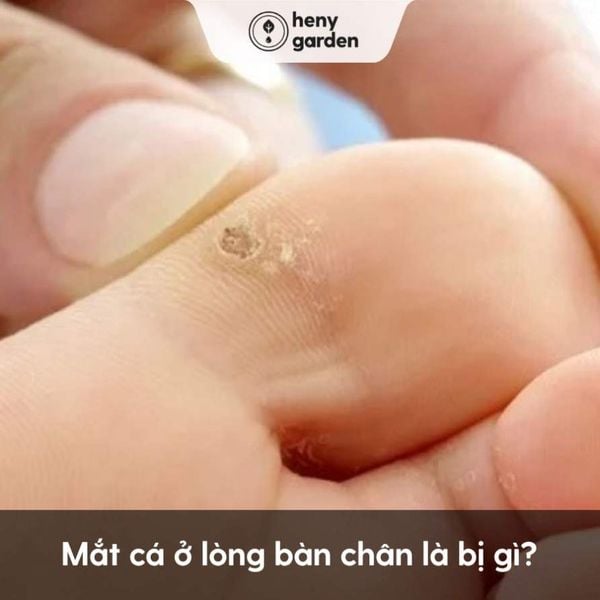 6. Cách Kết Hợp Ngâm Nước Muối Với Các Phương Pháp Chăm Sóc Khác