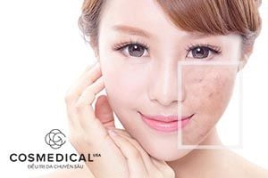 Sạch nhẹ nhàng cho da nhạy cảm với Chamomile Facial Cleanser