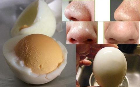 3+ cách trị mụn đầu đen bằng trứng HIỆU QUẢ tại nhà 100%