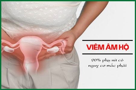 Viêm Âm Đạo – sinh hoạt thế nào
