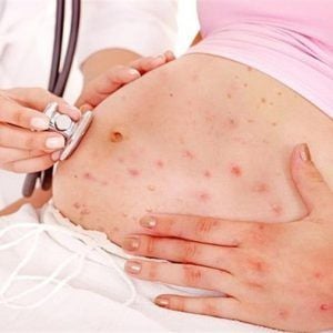 Thuỷ đậu ảnh hưởng thai nhi như thế nào?