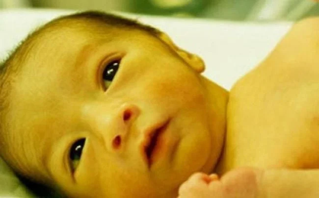 Trẻ vàng da có nguy hiểm không, làm sao hết?