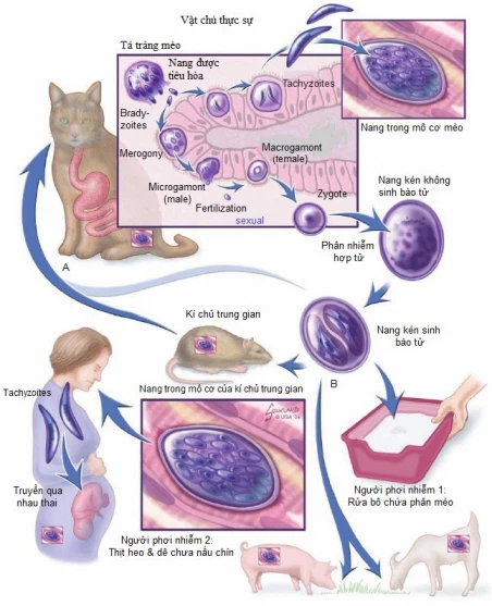 Nhiễm Toxoplasma
