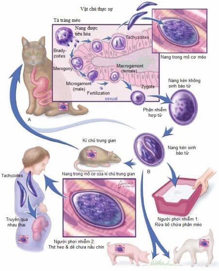 Nhiễm Toxoplasma