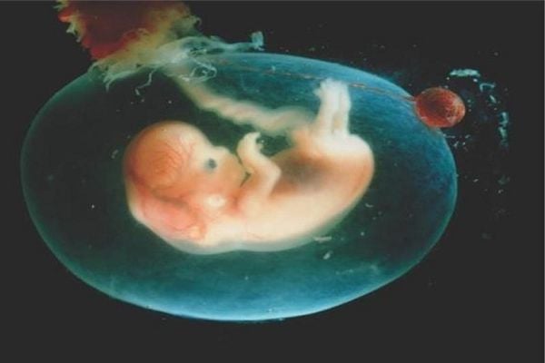 Khi nào nước ối đục cảnh báo nguy hiểm?