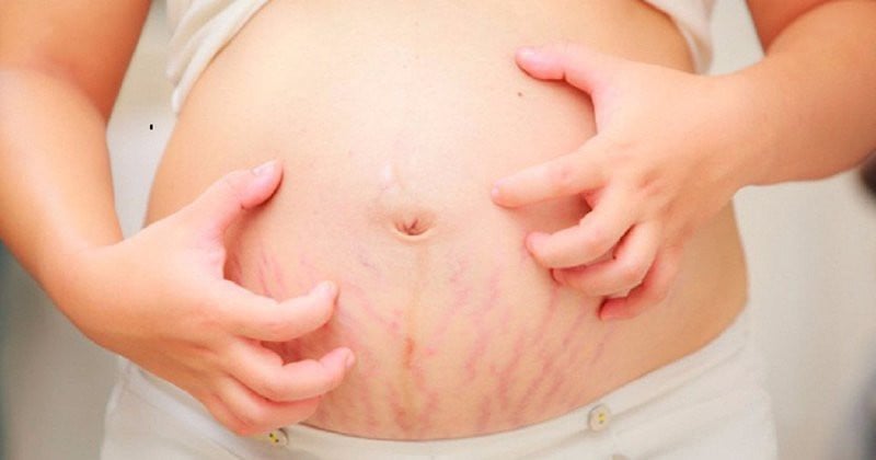 Cách trị ngứa cho bà bầu khi mang thai