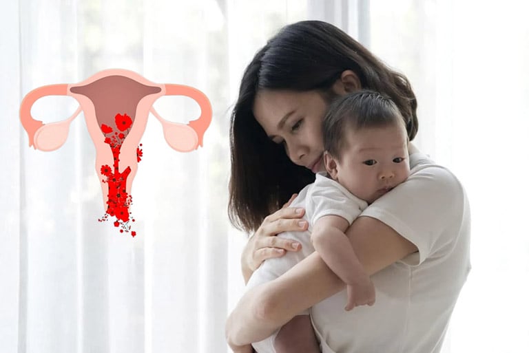 Rong kinh sau sanh có nguy hiểm không?