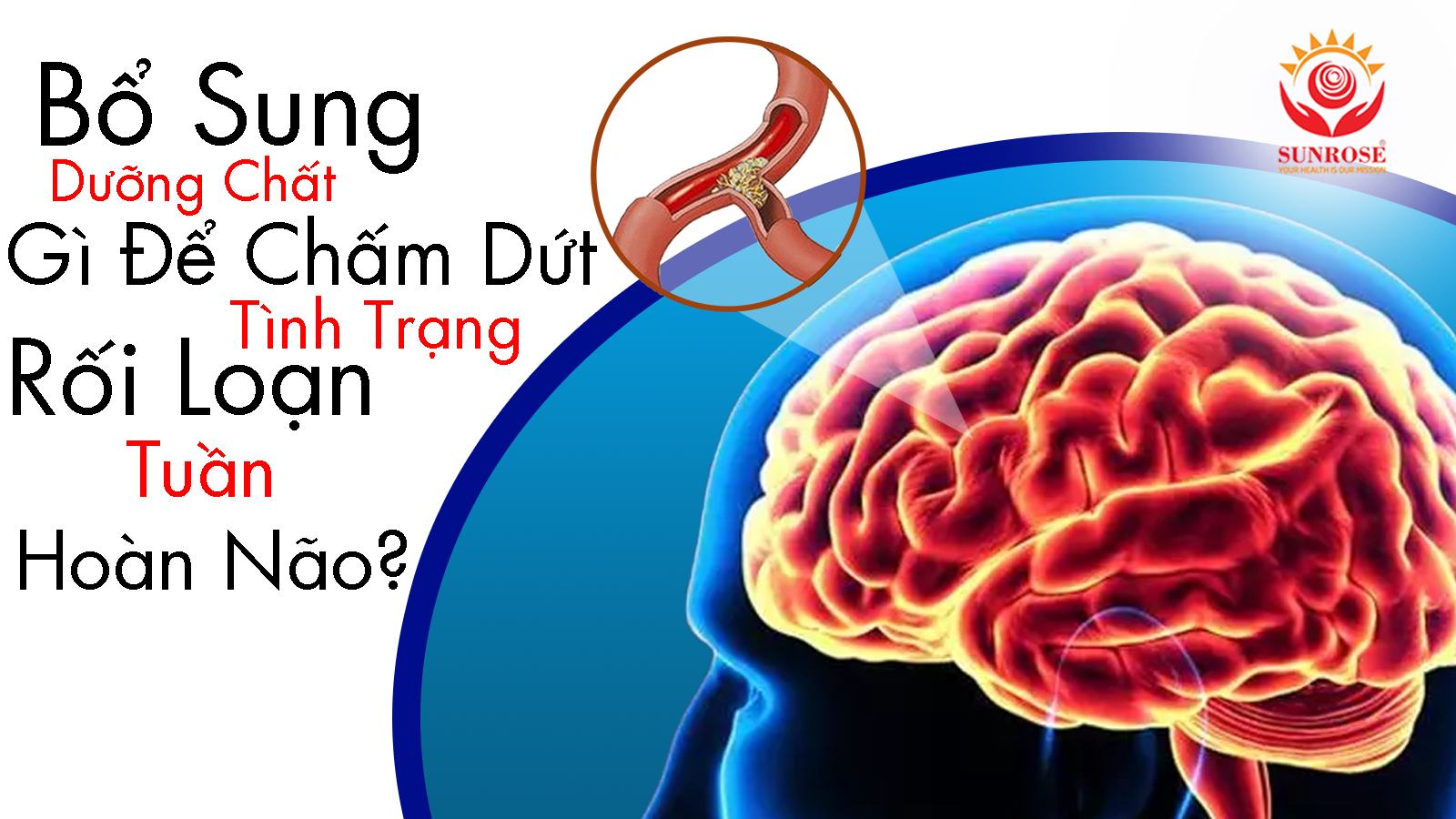 Bổ Sung Dưỡng Chất Gì Để Chấm Dứt Tình Trạng Rối Loạn Tuần Hoàn Não?