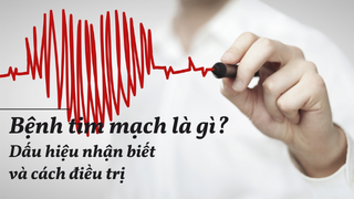 Bệnh tim mạch là gì? Dấu hiệu nhận biết và cách điều trị