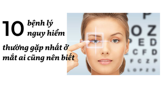 10 bệnh lý nguy hiểm thường gặp nhất ở mắt ai cũng nên biết