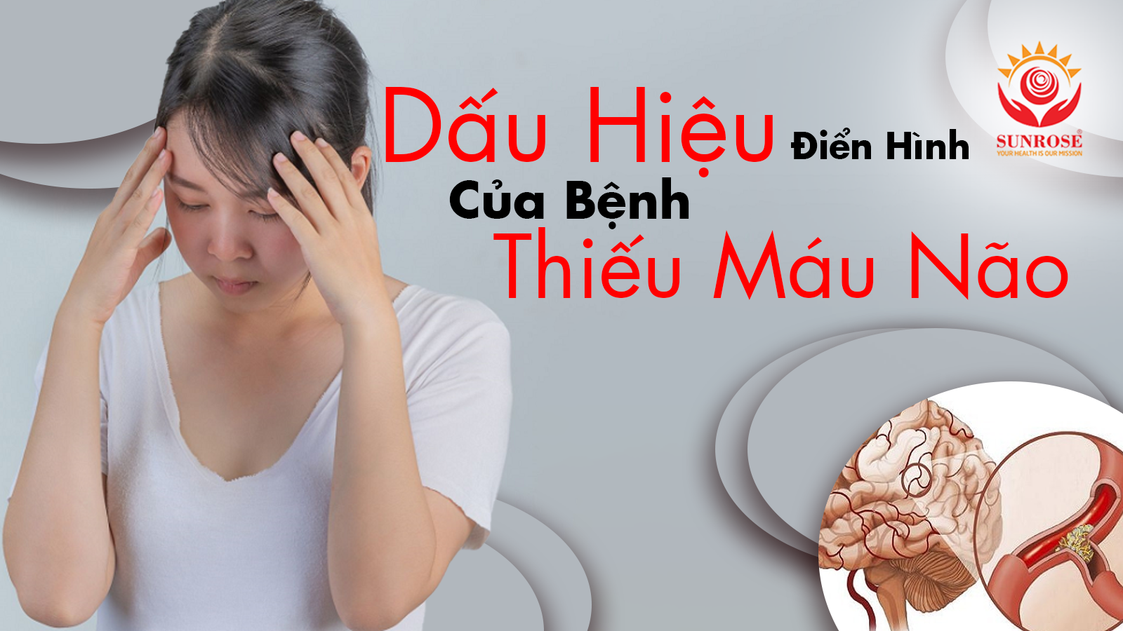 Dấu Hiệu Điển Hình Của Bệnh Thiếu Máu Não