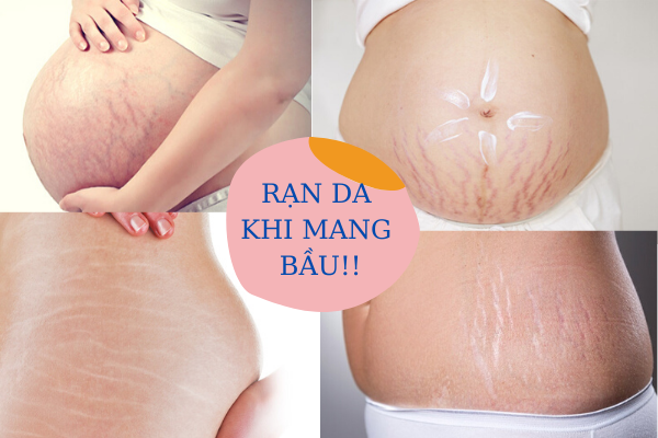 Sức khỏe tổng quát