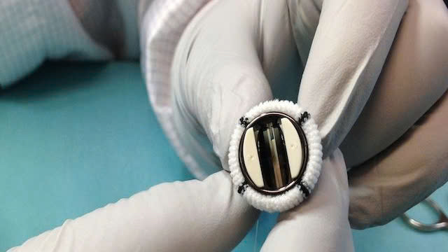 Thay van tim ở bệnh viện nào tốt nhất?