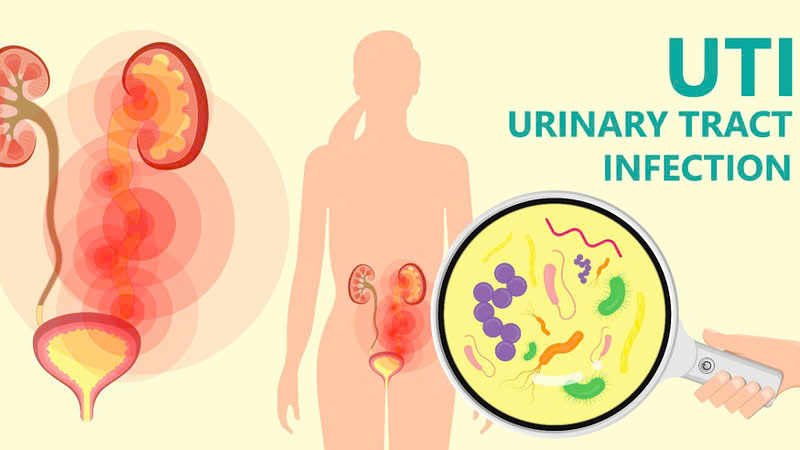 Viêm đường tiết niệu khám ở khoa nào, bệnh viện nào tốt nhất?