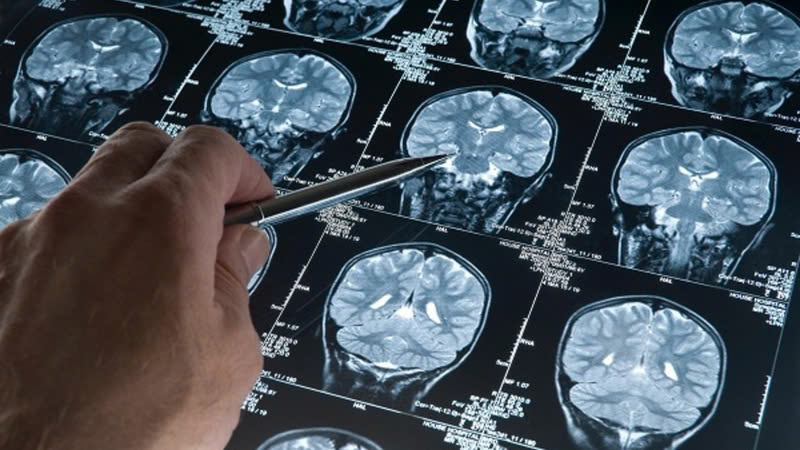 Chụp não ở bệnh viện nào tốt nhất hiện nay?