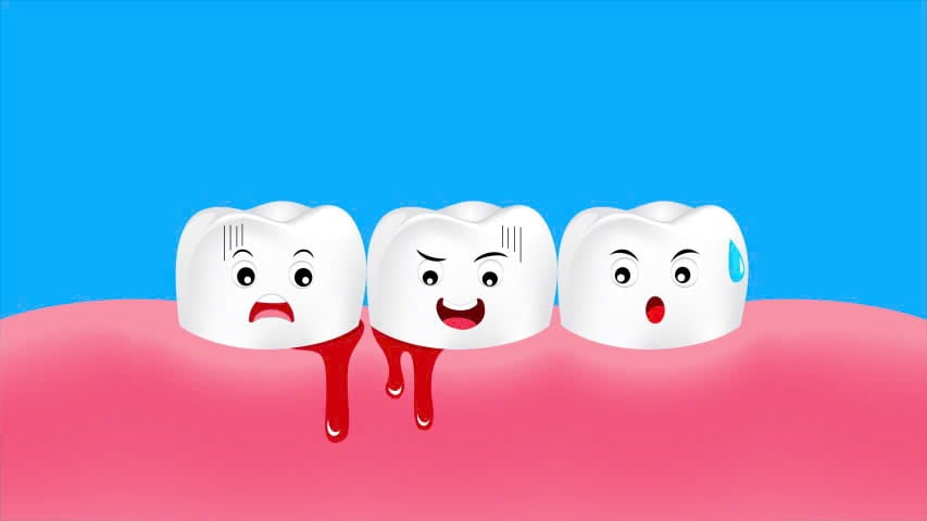 Bà bầu bị chảy máu chân răng